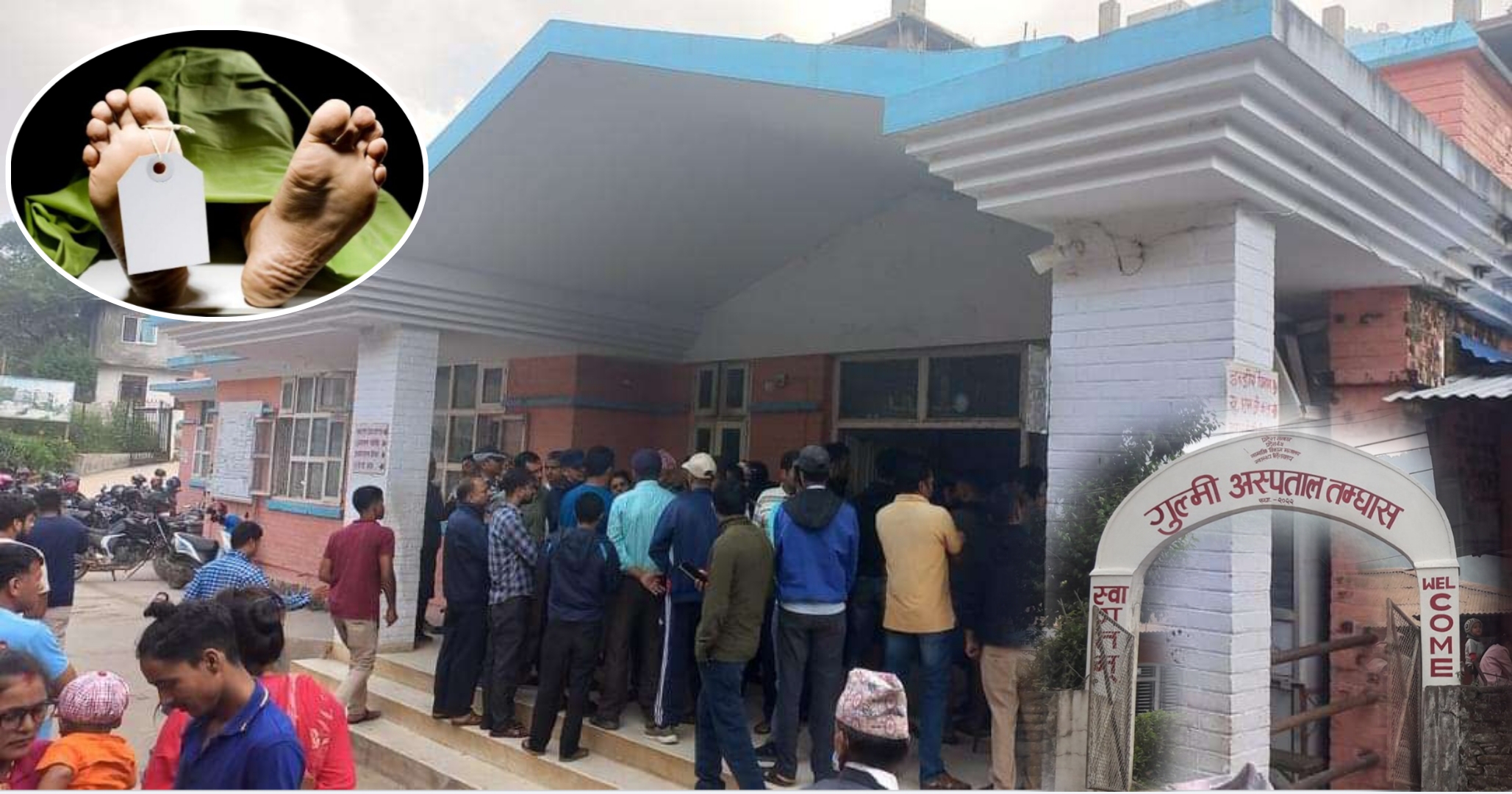 गुल्मी अस्पतालकाे लाहापरवाहीले सात वार्षिय बालिकाको मृत्यु